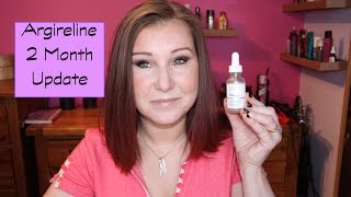 The Ordinary Skincare  Argireline  2 Month Update [upl. by Kit]