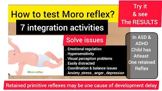 Moro reflexissues if retainedHow to test Moro reflex amp 7 integration activitiesprimitive reflex [upl. by Copp101]