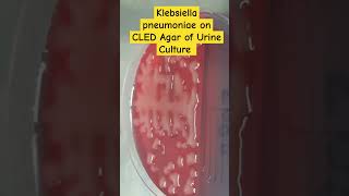 Klebsiella pneumoniae colony morphology on CLED of Urine Culture [upl. by Gertrud849]