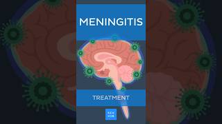 Meningitis Treatment  Kenhub meningitis [upl. by Iasi]