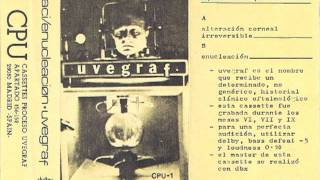 Uvegraf  Enucleación excerpt [upl. by Aya]