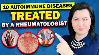 Top 10 Autoimmune Diseases A Rheumatologist Diagnose and Treat [upl. by Aihtniroc]