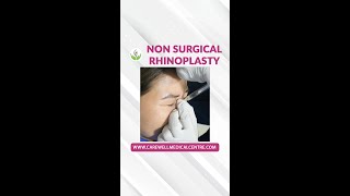 NonSurgical Rhinoplasty How Its Done  Nose Filler How It Works  Nose Job The Process [upl. by Nerua]