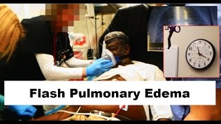 Flash Pulmonary Edema Emergency [upl. by Dylan]