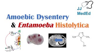 Amebiasis Amoebic Dysentery  Entamoeba histolytica Pathogenesis Signs amp Symptoms Treatment [upl. by Farnsworth162]