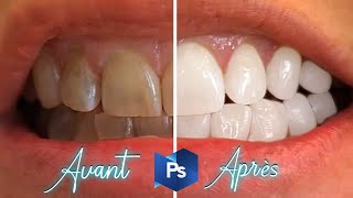 TUTO BOY COMMENT BLANCHIR LES DENTS SUR PHOTOSHOP [upl. by Hirai]