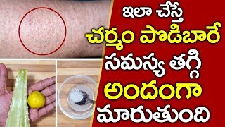 చర్మం పొడిబారటం తగ్గాలంటే I Dry Skin Problems in Telugu I Beauty Tips Telugu I Everything in Telugu [upl. by Nyleaj53]