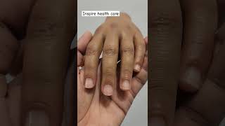 Silicone Artificial Hand 🖐️ artificialhand cosmetichand [upl. by Whall]