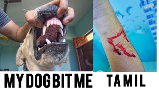 My dog bit me  RABIES ALERT  EXPLAINED IN TAMIL [upl. by Arretnahs852]