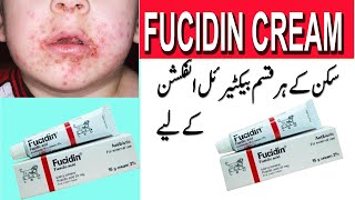 fusidic acid cream how to use Fusidic acid cream fucidin cream in urdu [upl. by Manbahs]