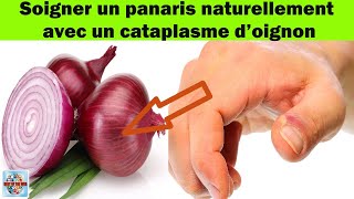 Astuces de grandmère  comment soigner un panaris avec un cataplasme à base doignon [upl. by Eldnek249]