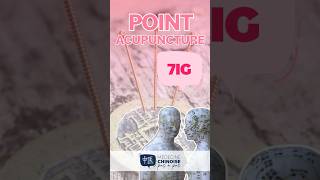 POINT D’ACUPUNCTURE  7IG  Zhi Zheng acupuncture acupuncturepoints medecinechinoise [upl. by Libenson206]