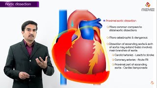 Aortic dissection  Definition Types  Classification and Pathophysiology  Part 1 pathology USMLE [upl. by Ynoble508]