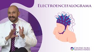 Electroencefalograma [upl. by Yrehc]