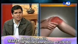 Artrosis de Rodilla Klgo Marco Loyola [upl. by Montgomery]