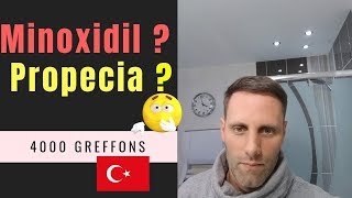 Greffe de cheveux FUE en Turquie Vidéo 19  Minoxidil Finasteride et Trioxidil 4000 Greffons [upl. by Felike885]