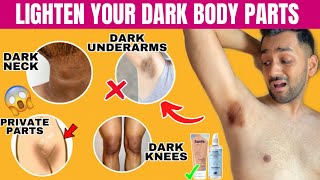 Get rid of Dark Neck amp Dark Underarms in Just 30 Days with Sanfe Spotlite Cream amp Serum  ANKIT TV [upl. by Cinnamon]