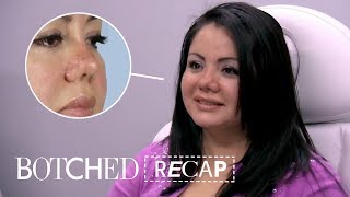 Lipo Patient Gets Surprise Piggy Nose Instead  Botched Recap S5 E10  E [upl. by Nonnair721]