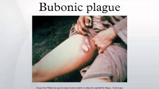 Bubonic plague [upl. by Magnum562]