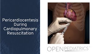 Pericardiocentesis During Cardiopulmonary Resuscitation by T Wolbrink  OPENPediatrics [upl. by Yrocal716]