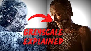 Greyscale Explained The Westerosi Disease That Leaves Flesh and Skin Dead [upl. by Cheslie862]