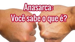 Anasarca Significado  O que é  Causas e Tratamentos [upl. by Ayahsal31]