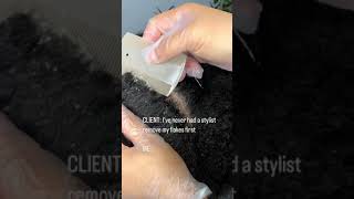 Flaky Scalp Removal On Natural Hair [upl. by Dalston607]