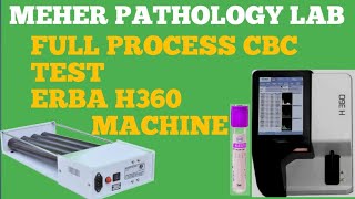 How to performed Cbc test in hindi full process cbc test erba H360 machine [upl. by Kenn]