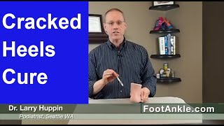 How to Treat Dry Cracked Heels with Seattle Foot Doctor Larry Huppin [upl. by Einram176]