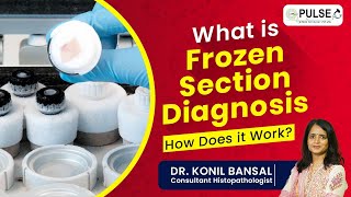 What is Frozen Section Diagnosis  Uses Procedures and Margin States All Explained [upl. by Rosenquist304]