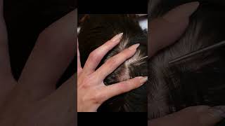 ASMR Intense Scalp SCRATCHING and NITPICKING with Nails Real Person shorts short asmr [upl. by Eenafets876]