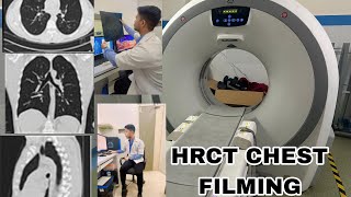 HRCT FULL FILMING 🎞️ [upl. by Lyndsey700]