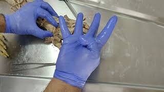 Dissection  Revision of Lumbricals of the hand [upl. by Ursula]