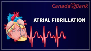 Atrial Fibrillation [upl. by Aimak]