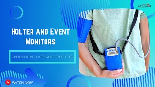 Holter and Event Monitors Procedure Uses and Results [upl. by Eillac]