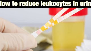 How to reduce leukocytes in urine [upl. by Allister]