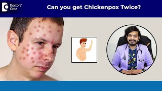 Can you get CHICKENPOX Twice Chickenpox Vaccine amp Treatment DrLeela Mohan P V R Doctors Circle [upl. by Selfridge]