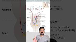 Internuclear Ophthalmoplegia concept explained in 3minutes [upl. by Erodavlas840]