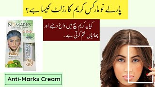 Parley No Marks Cream Review  Skin whitening cream  Anti Marks Cream [upl. by Eiknarf]