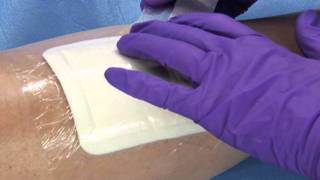 3M™ Tegaderm™ Foam Adhesive Dressing  Application and Removal [upl. by Rexana900]