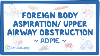 Foreign body aspiration  upper airway obstruction Nursing Process [upl. by Drandell]