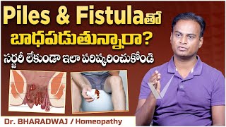 పైల్స్ కు సర్జరీ లేకుండా పరిష్కారం  Piles Treatment at Home in Telugu  Fissure  Vikram Tv Health [upl. by Gnouh]