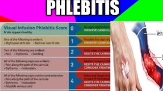 phlebitisthrombophlebitisvip vipscorephlebitisdvt health nidhicreation2012 [upl. by Ardis630]