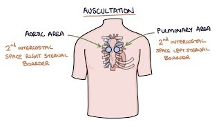 Heart Murmurs and Heart Sounds Visual Explanation for Students [upl. by Lekkim]