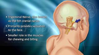 Understanding Trigeminal Neuralgia  eBrainMDcom [upl. by Arluene]