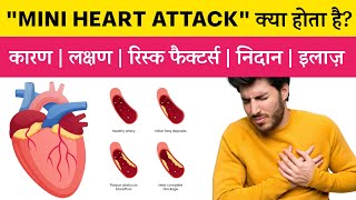 क्या quotMini Heart Attackquot ऐसा भी कुछ होता है  Mild Heart Attack  Unstable Angina  NSTEMI [upl. by Tisman]