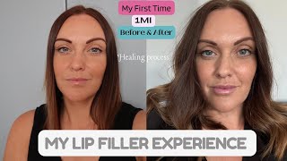 My Lip Filler Experience  What To Expect When Healing  05ml or 1ml [upl. by Annayd150]