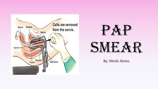 OampG Pap smear  revision for medical students [upl. by Osbourne]