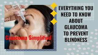 How to prevent glaucoma disease [upl. by Googins]