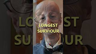 PROGERIA shortsfeed itsfact viral tiktok fact trending biology reel [upl. by Norma437]